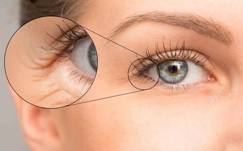 ماسک زیر چشم برای سلامت پوست